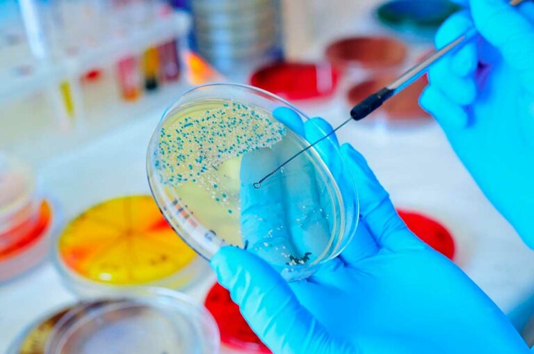 bacterias_1122280157_12072023092307